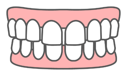 歯と歯の間に隙間がある「すきっ歯・空隙歯列」