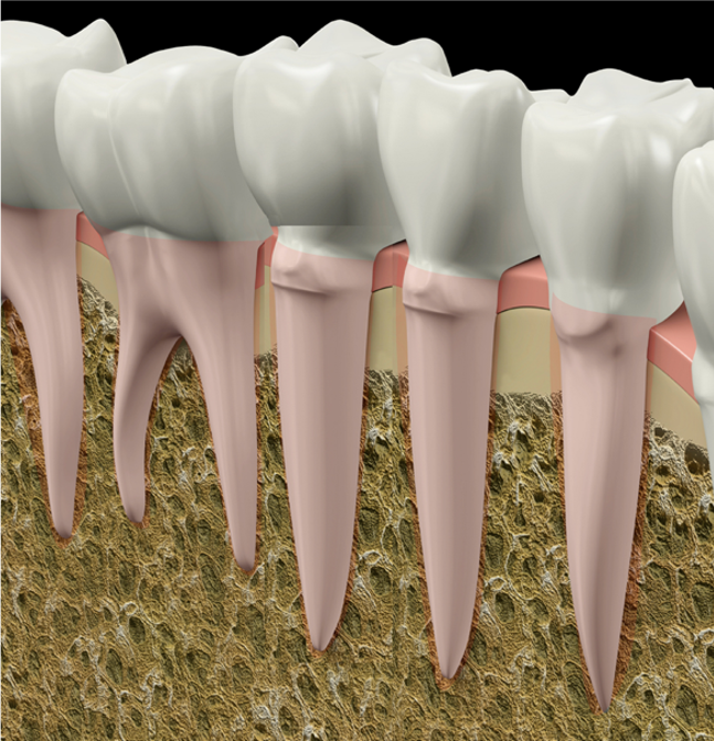 なぜ、矯正歯科でクリーニングを提供するのか？